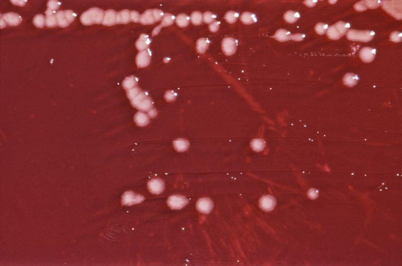 假單胞菌。（圖片中為綠膿桿菌Pseudomonas aeruginosa） 圖片來源：wiki