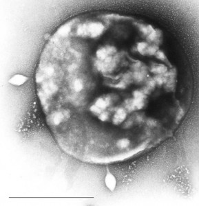 正在被STSV1噬菌體感染的Sulfolobus。圖片來源：wiki