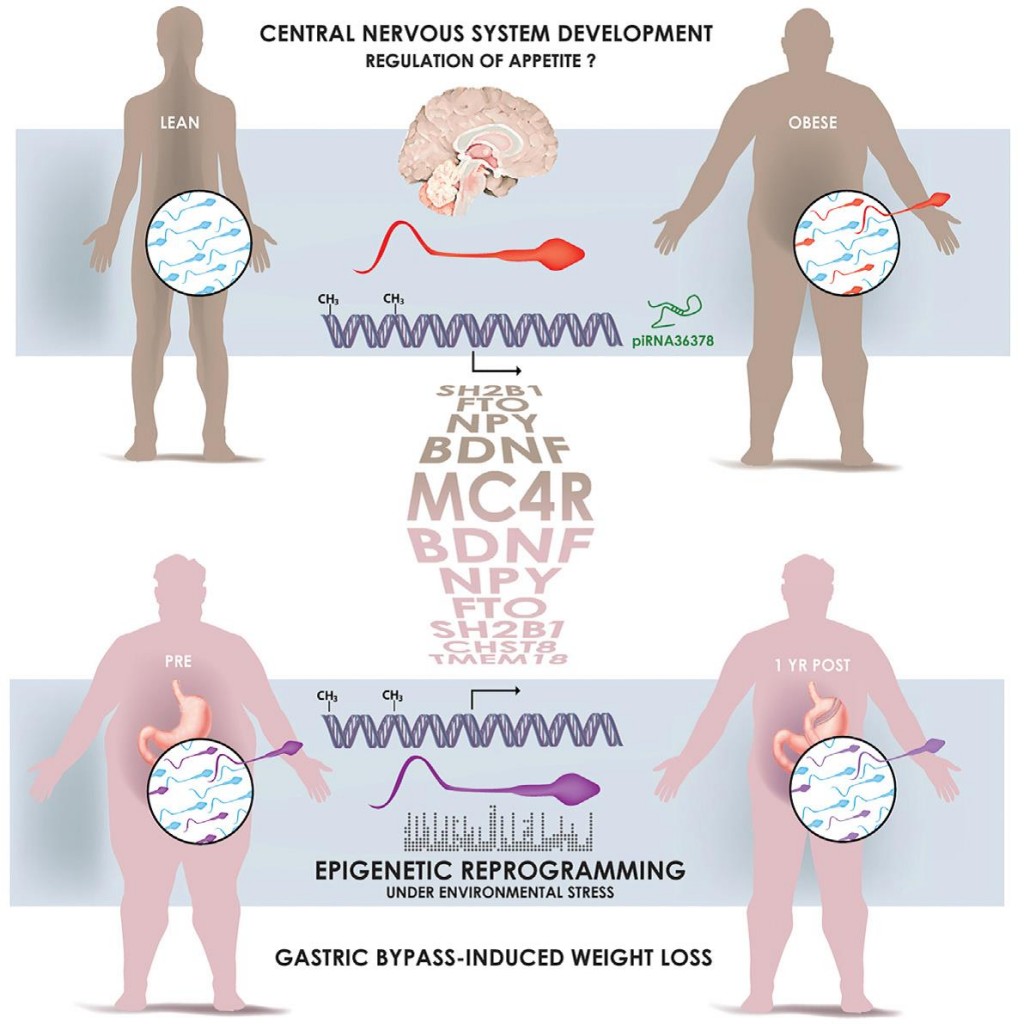 肥胖和食道分流手術改變了精子的表觀遺傳標記（Donkin and Versteyhe et al. Cell Metabolism. DOI: 10.1016/j.cmet.2015.11.004）