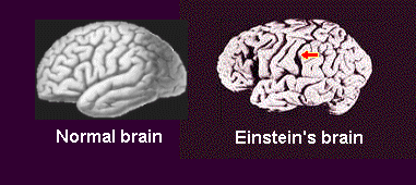 愛因斯坦之腦