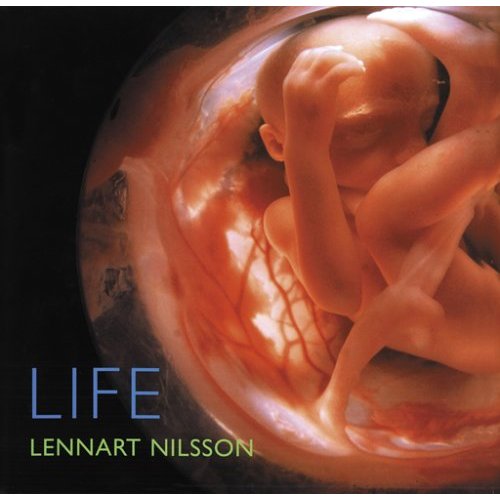 胚胎攝影術的始祖：拉斯倪爾森的照片。（皮膚是假的，用光影合成）