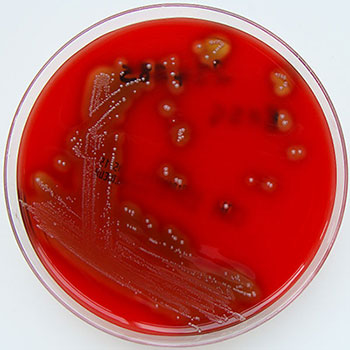 化膿性鏈球菌是A群鏈球菌分類中唯一的物種。