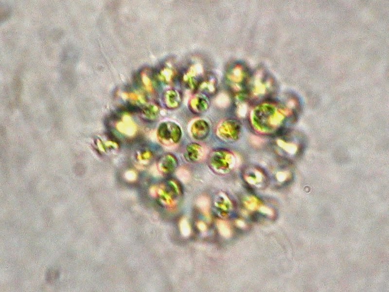 Microcystis_aeruginosa