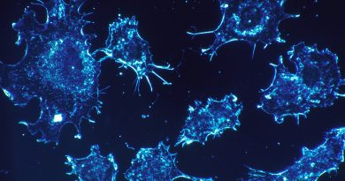 科學家發現腫瘤裡躲著細菌,難道癌細胞和細菌沆瀣一氣? 科學家發現腫瘤裡躲著細菌,難道癌細胞和細菌沆瀣一氣?