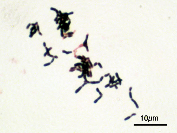 Bifidobacterium_adolescentis_Gram